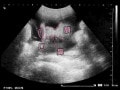妊娠38週 胎児の体重やエコー写真・子宮口の開きや出産の流れ