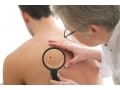【症例画像】皮膚がん・皮膚悪性腫瘍の症状・治療法
