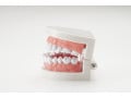 歯のぐらつき・抜けそうな永久歯を固定する治療法