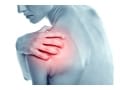 外傷性肩関節脱臼の症状・原因・治療