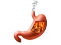 胃もたれの原因とツボによる改善法
