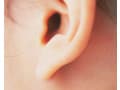 ピアスで耳がちぎれた・裂けた……切れ耳・外傷性耳垂裂の治療と原因