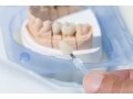 保険適用で奥歯を白い歯のブリッジに！2019年保険改正からの拡大点