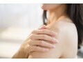 皮膚科の紫外線治療・紫外線療法の効果・費用・副作用