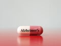 アミロイドβタンパクとは…アルツハイマー病の原因物質と考えられている理由