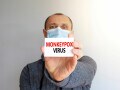 サル痘を過度に恐れる必要はない3つの理由…症状、治療薬も解説