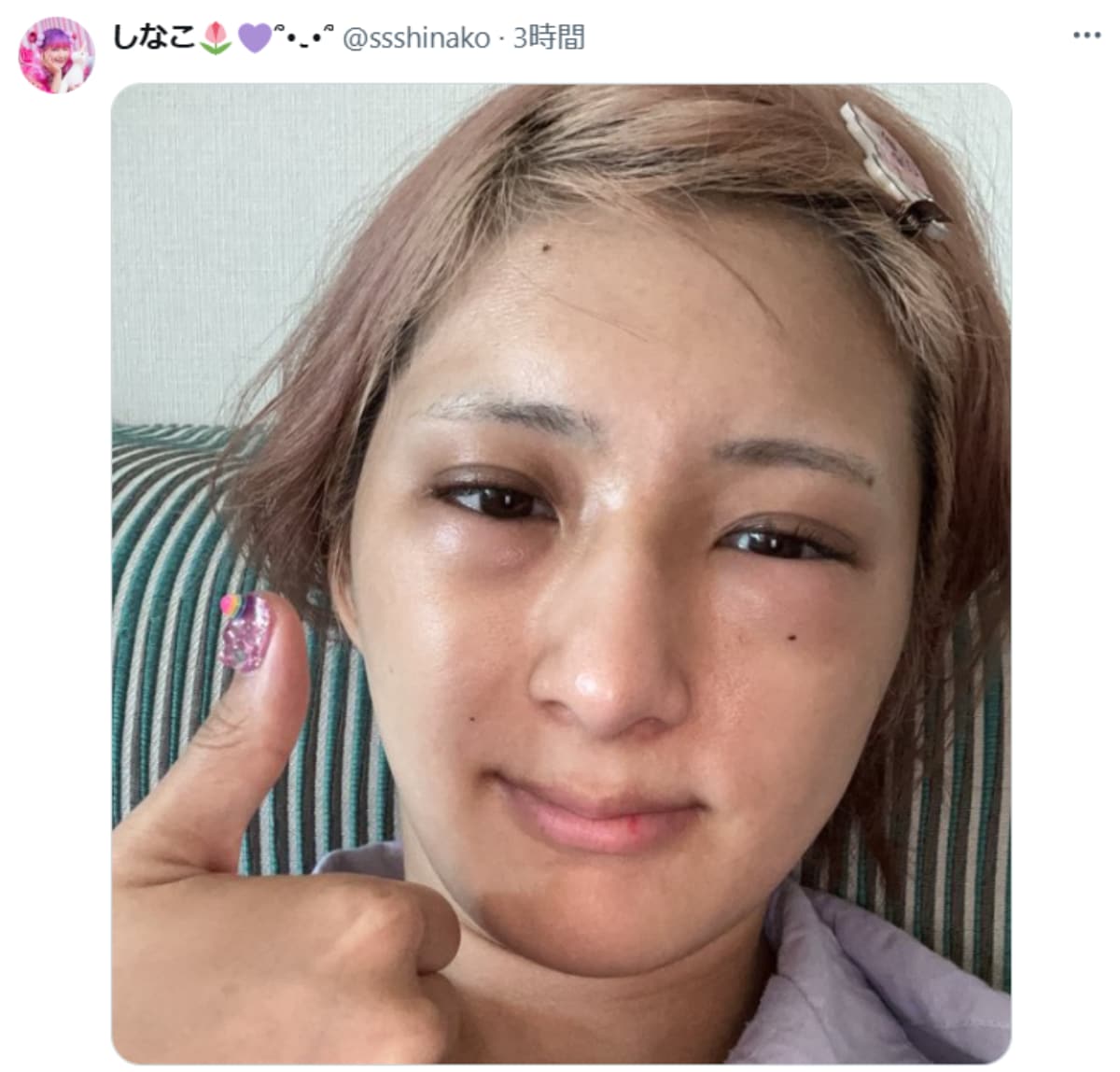 画像出典：しなこさん公式X（@ssshinako）
