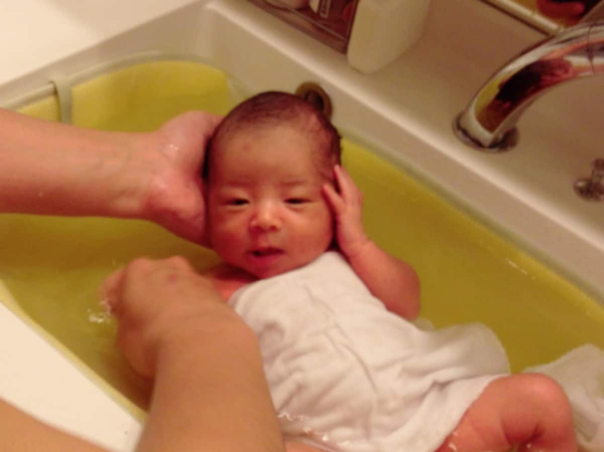 赤ちゃんの乳児湿疹 脂漏性湿疹 あせもの原因とケア 新生児育児 All About