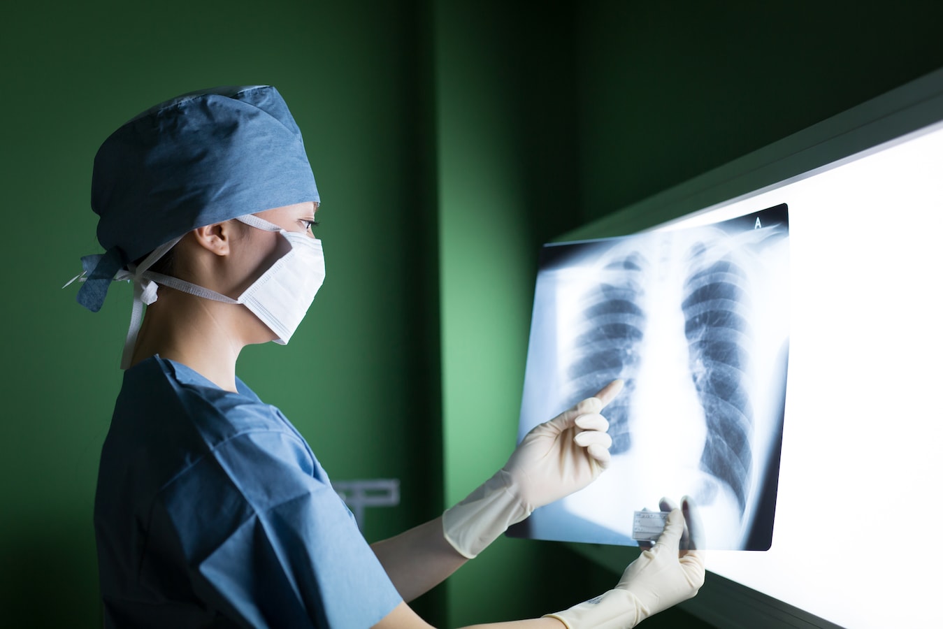 肺に影があるとき考えられる病気 再検査の必要性 健康診断 検診 人間ドック All About