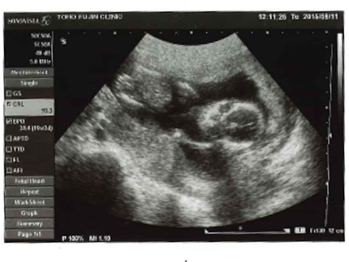 妊娠16週 赤ちゃんの性別が分かる人も 胎児の大きさ エコー写真