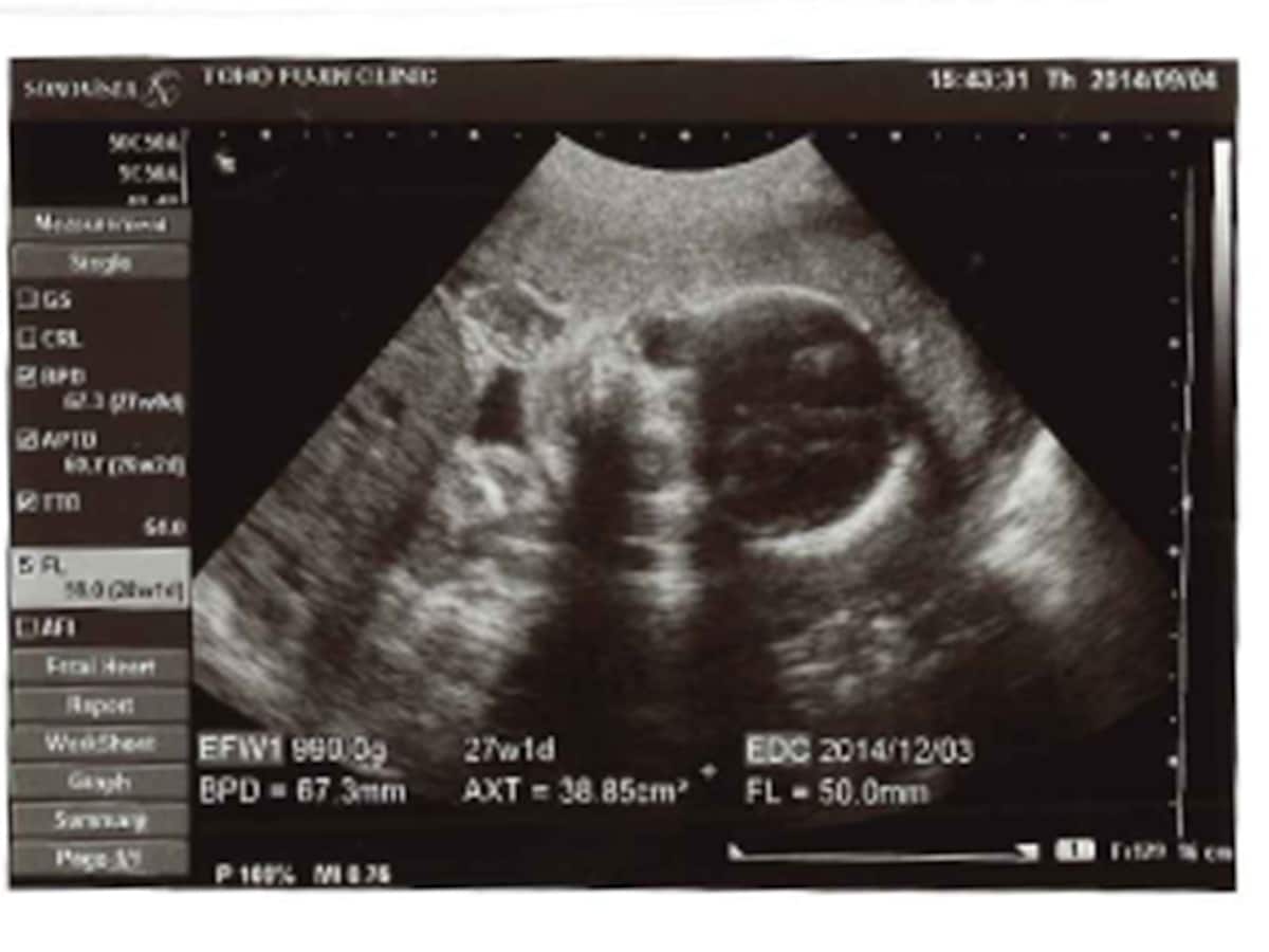 妊娠27週目エコー写真で見る胎児の体重や大きさ・早産になったら [妊娠中期] All About
