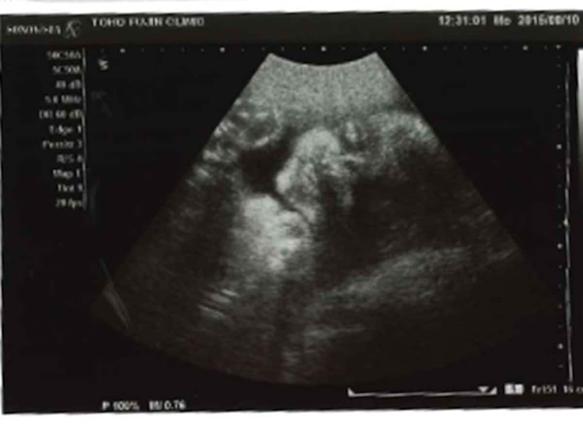 妊娠29週目 逆子は治る エコー写真で見る胎児の大きさ 体重 妊娠後期 All About
