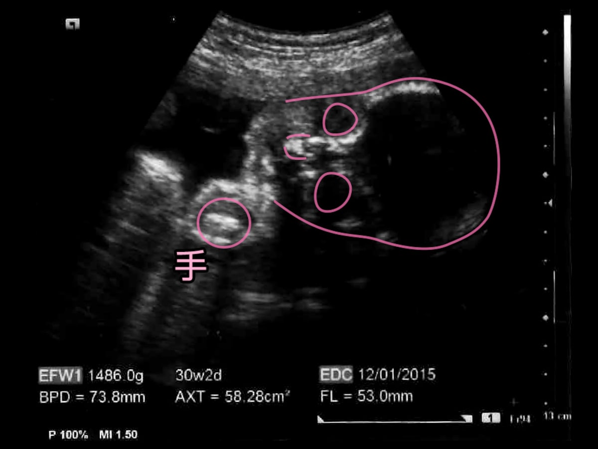 妊娠30週 胎児の体重や大きさをエコー写真で確認 逆子や早産の心配 妊娠後期 All About