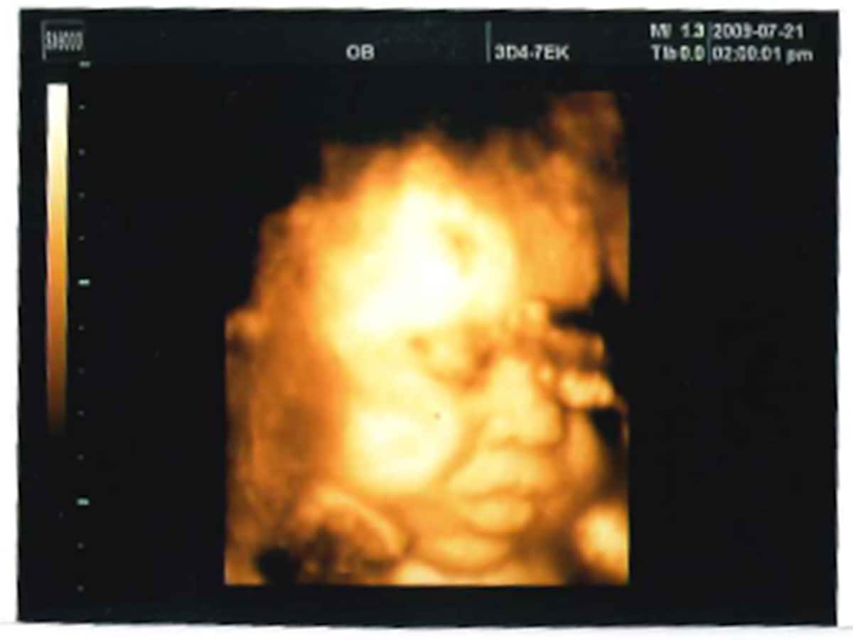 妊娠36週目 胎児の体重 エコー写真 出産がもし始まったら 妊娠後期 All About