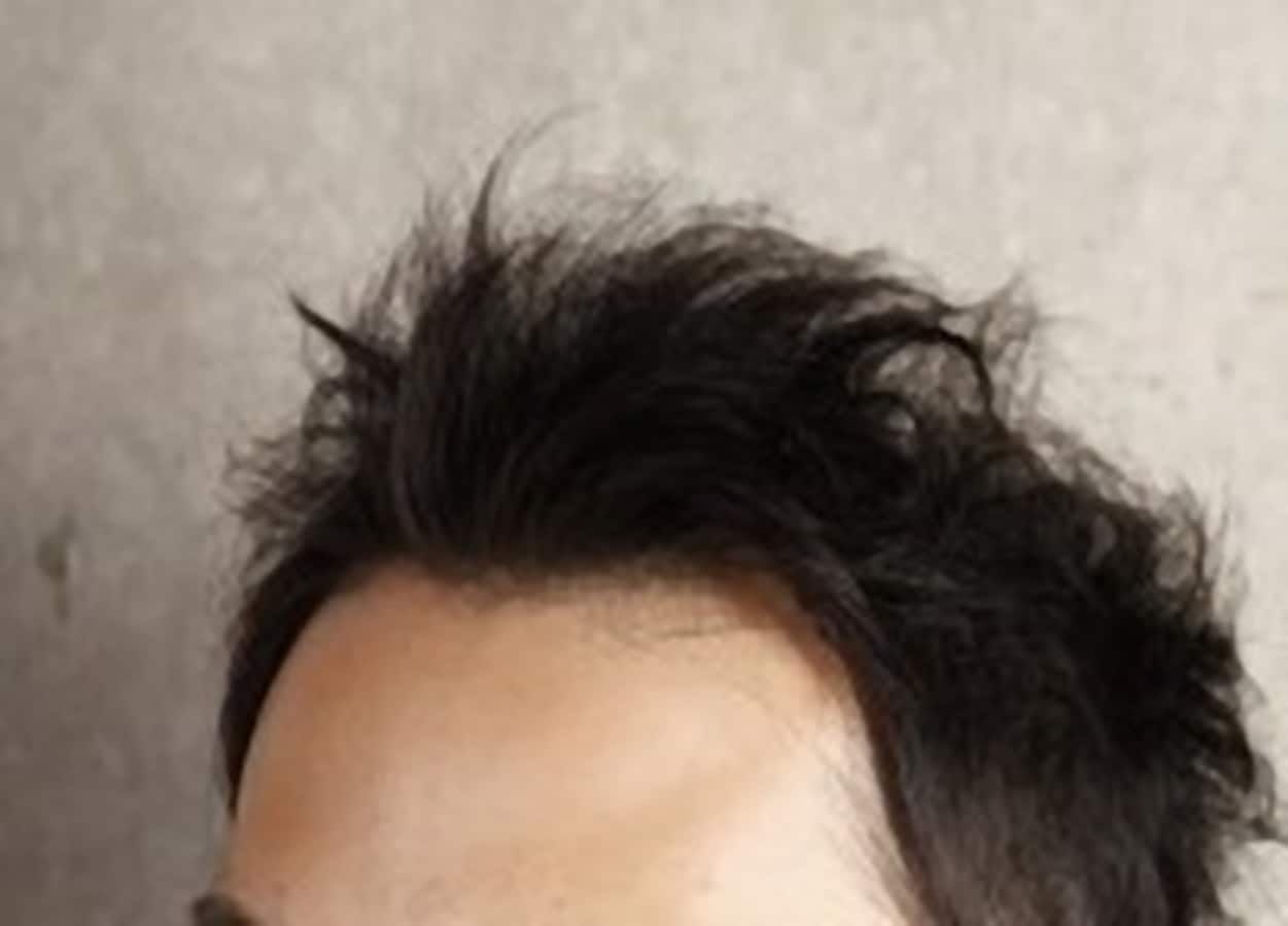 薄毛を引き起こす原因は6つのng生活習慣にあった 男のヘアケア All About 薄毛を引き起こす原因は6つのng生活習慣にあった 男のヘアケア All About