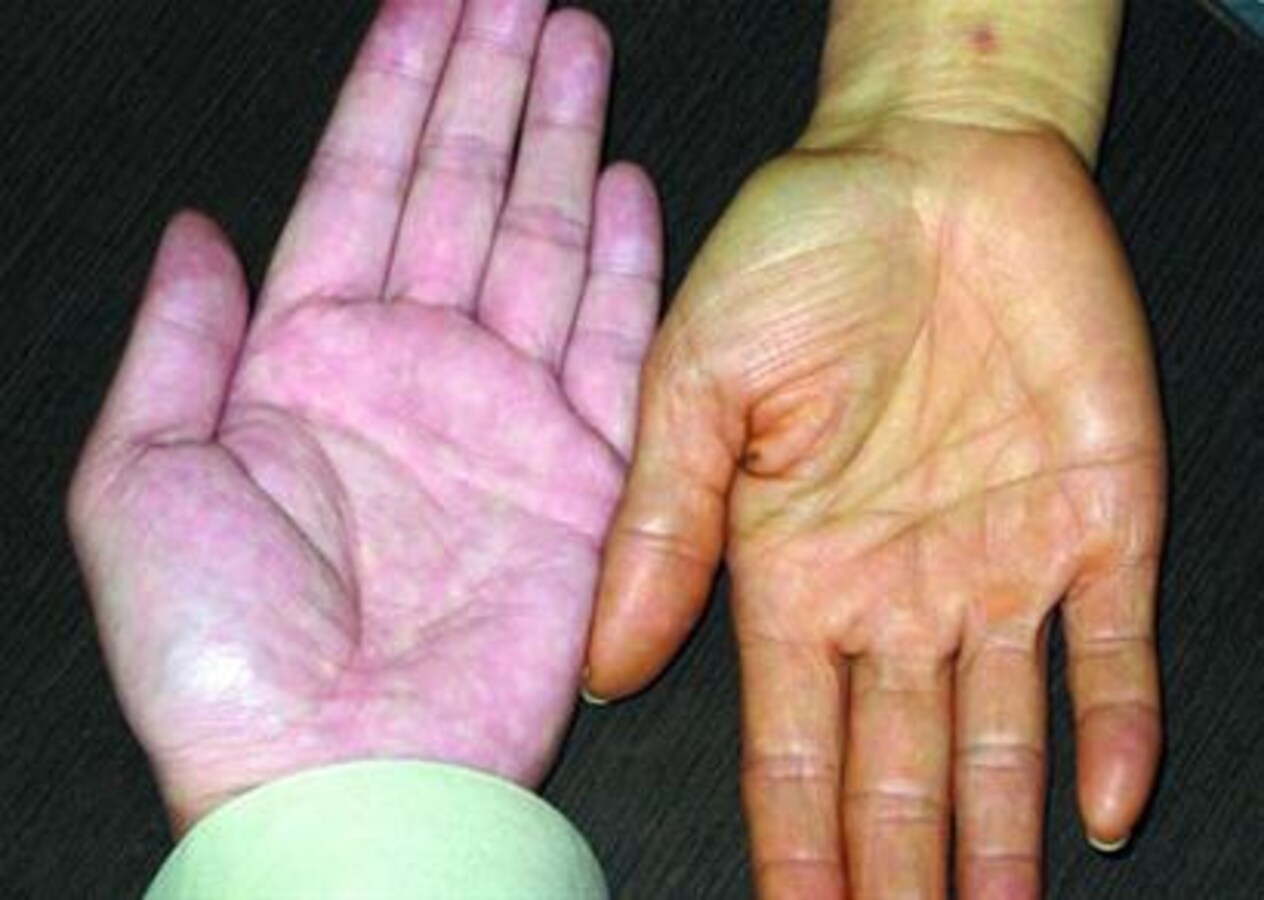 心配する必要がありますか?