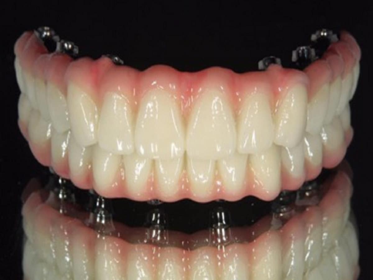 ウィートグラスの利点