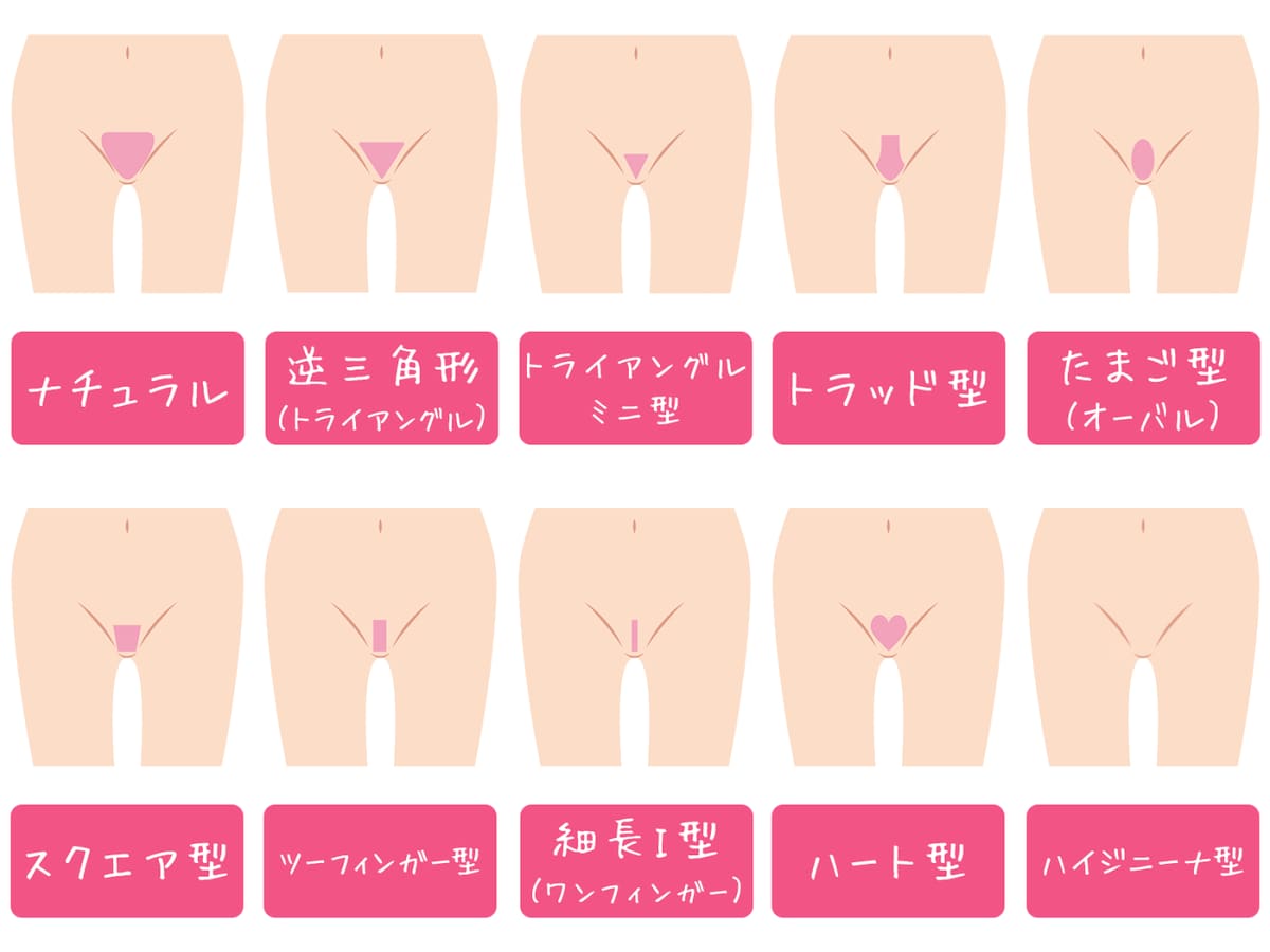 まんこ　形 VIO脱毛の形……アンダーヘアの形の作り方！人気の10種類 [脱毛・ムダ毛処理] All About