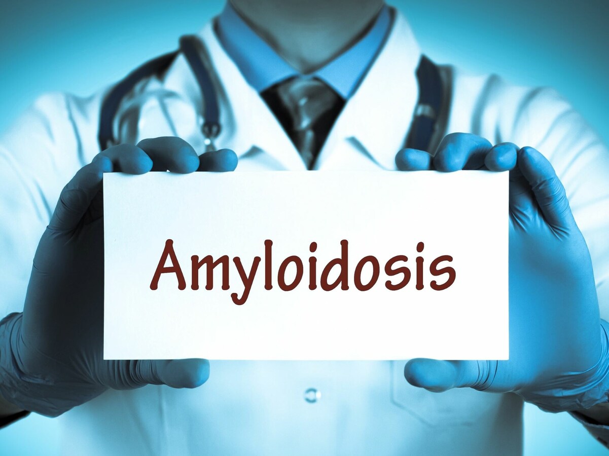 ループス疲労の原因は何ですか?