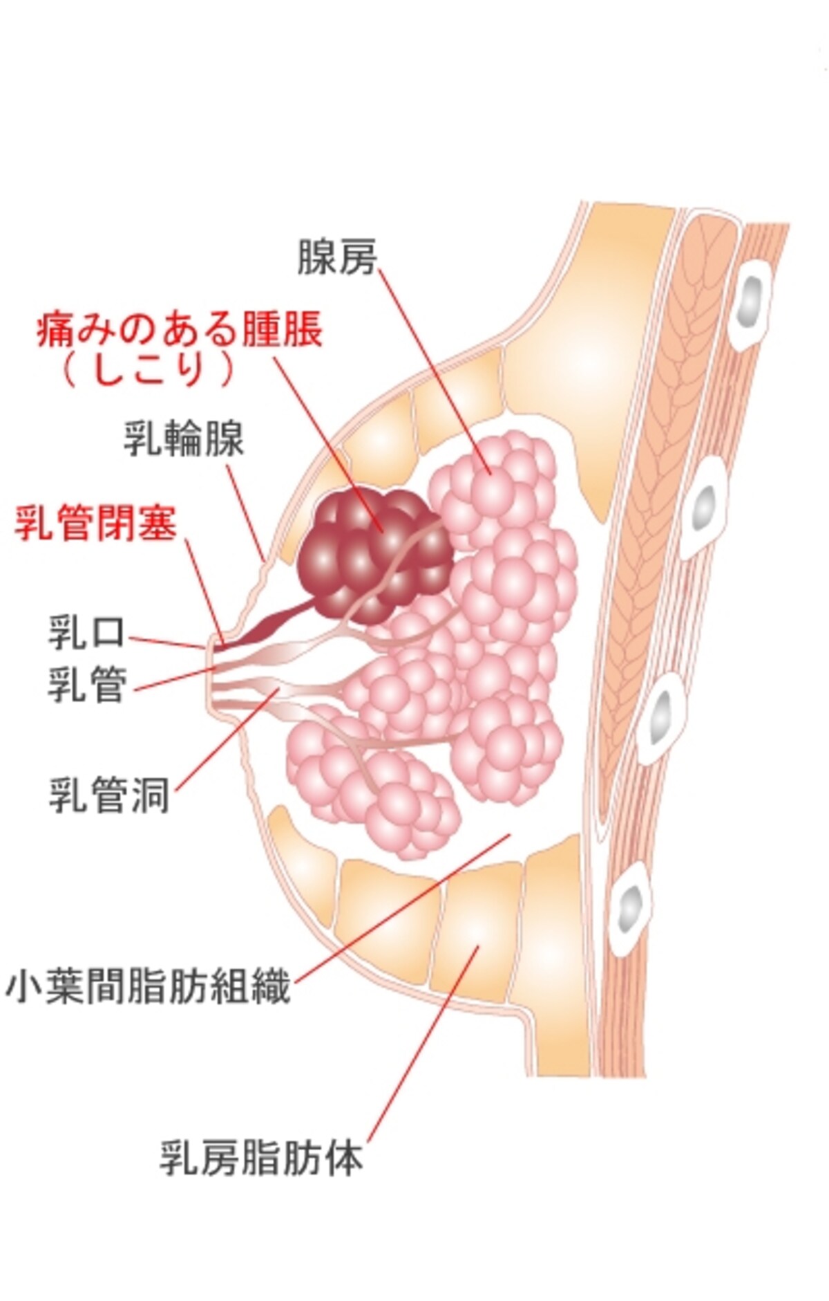 乳腺炎なりかけ