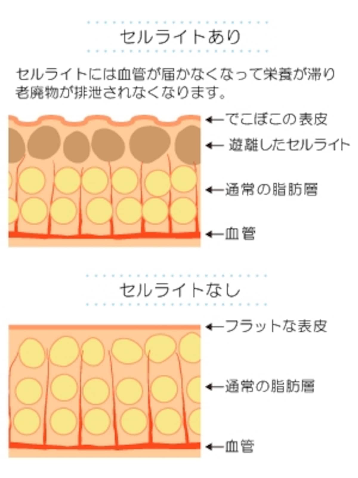 セルライトの仕組みを詳しくチェック！