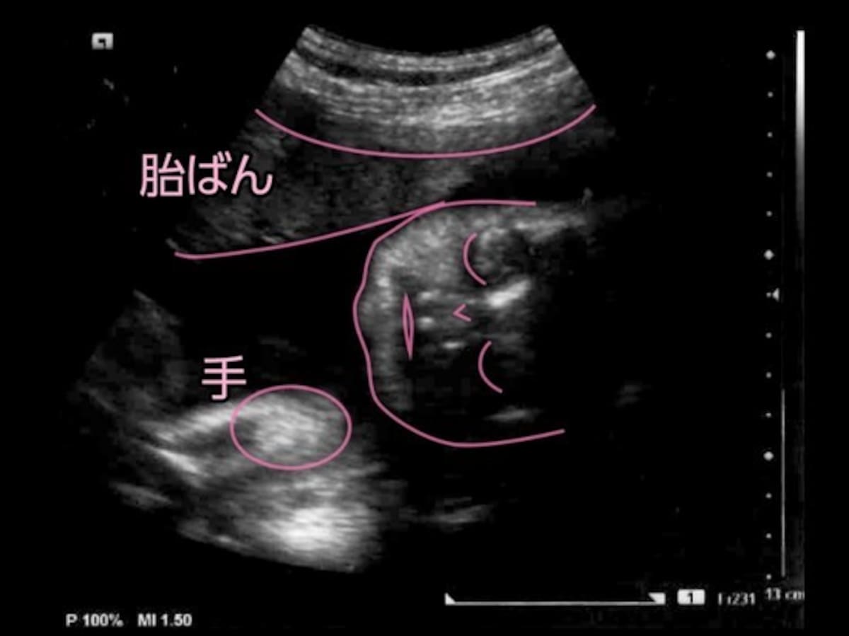 妊娠8ヶ月,八ヶ月,妊娠8カ月（妊娠31週）