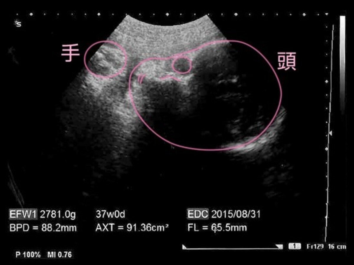 妊娠10ヶ月,十ヶ月,妊娠10カ月（妊娠37週）