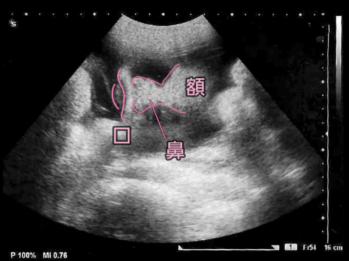 妊娠38週目（38w）の胎児のエコー写真・超音波写真