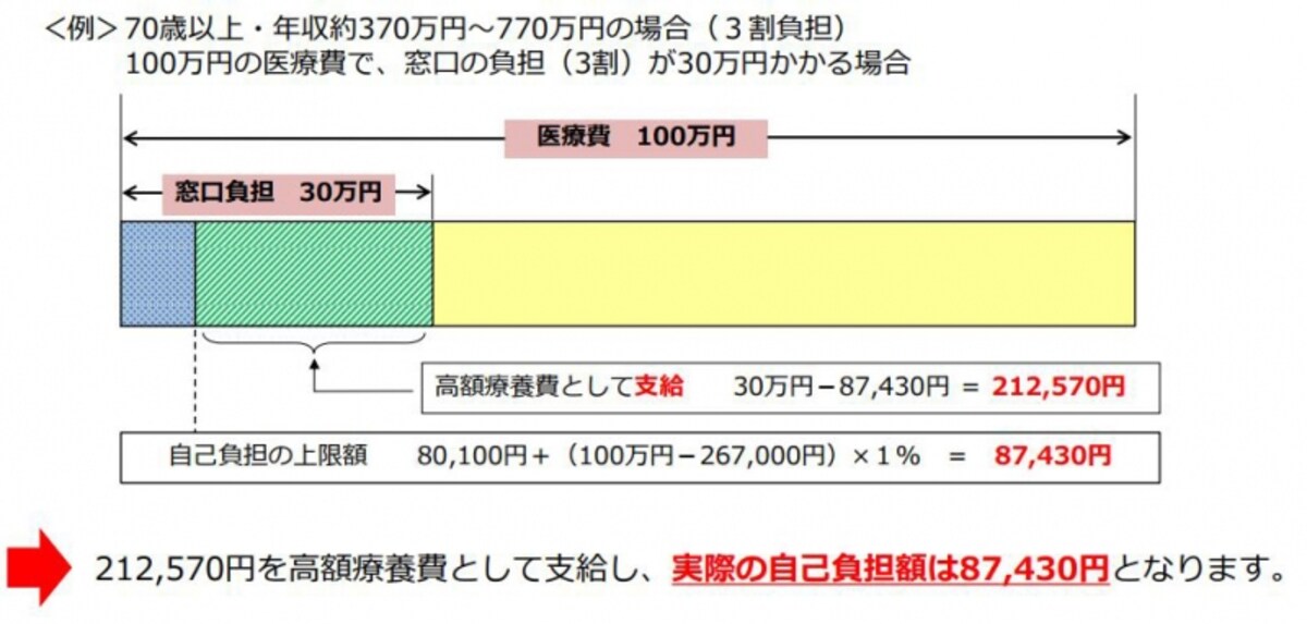 70歳以上の方の高額療養費のケーススタディ（出典：厚生労働省）
