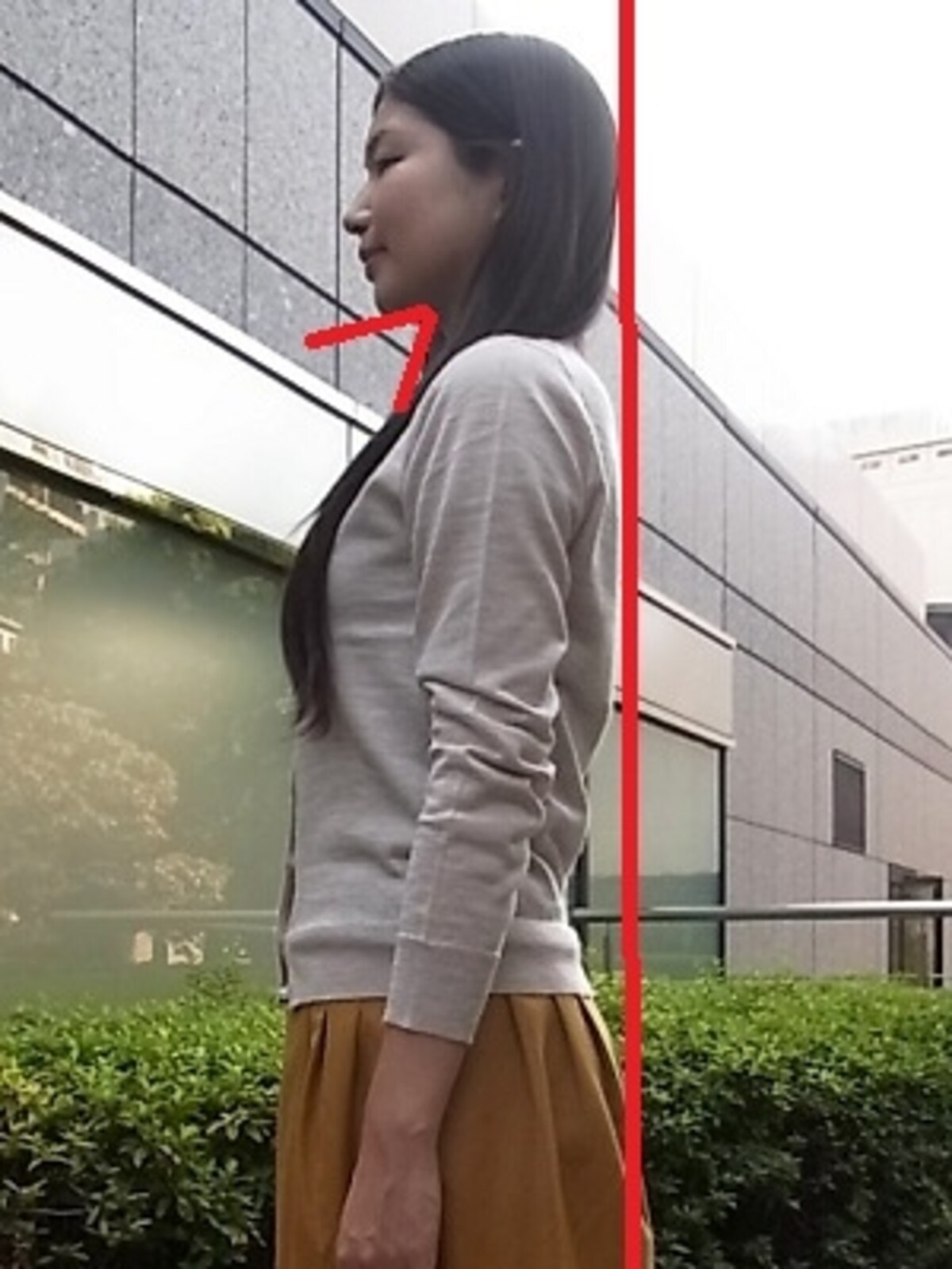 フェイスラインがスッキリ