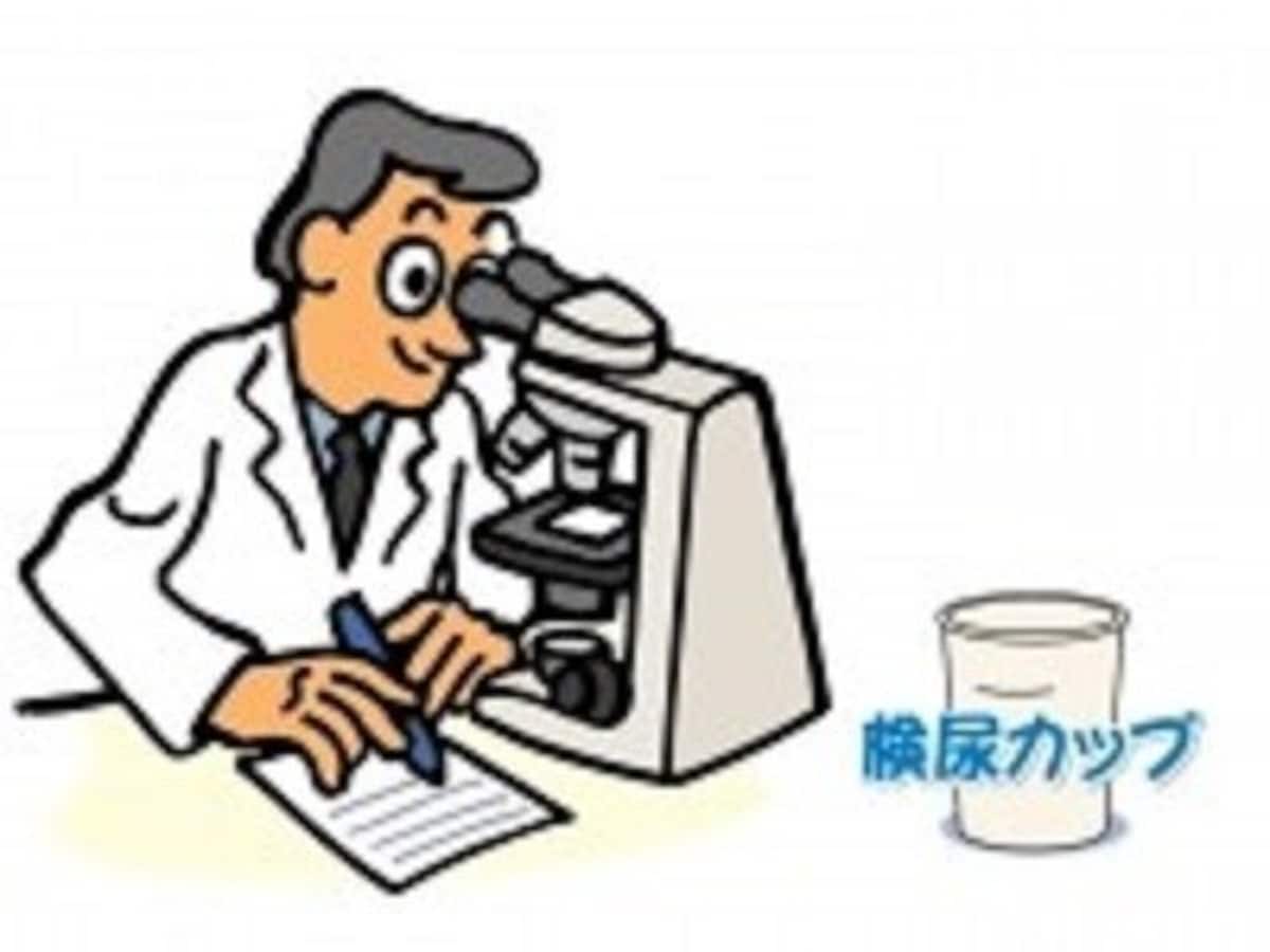 尿検査が重要になってきます