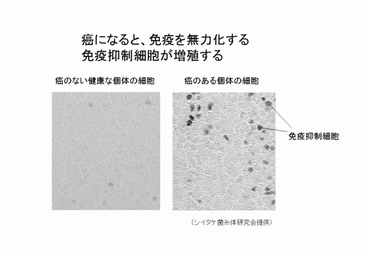 免疫力低下と免疫抑制細胞