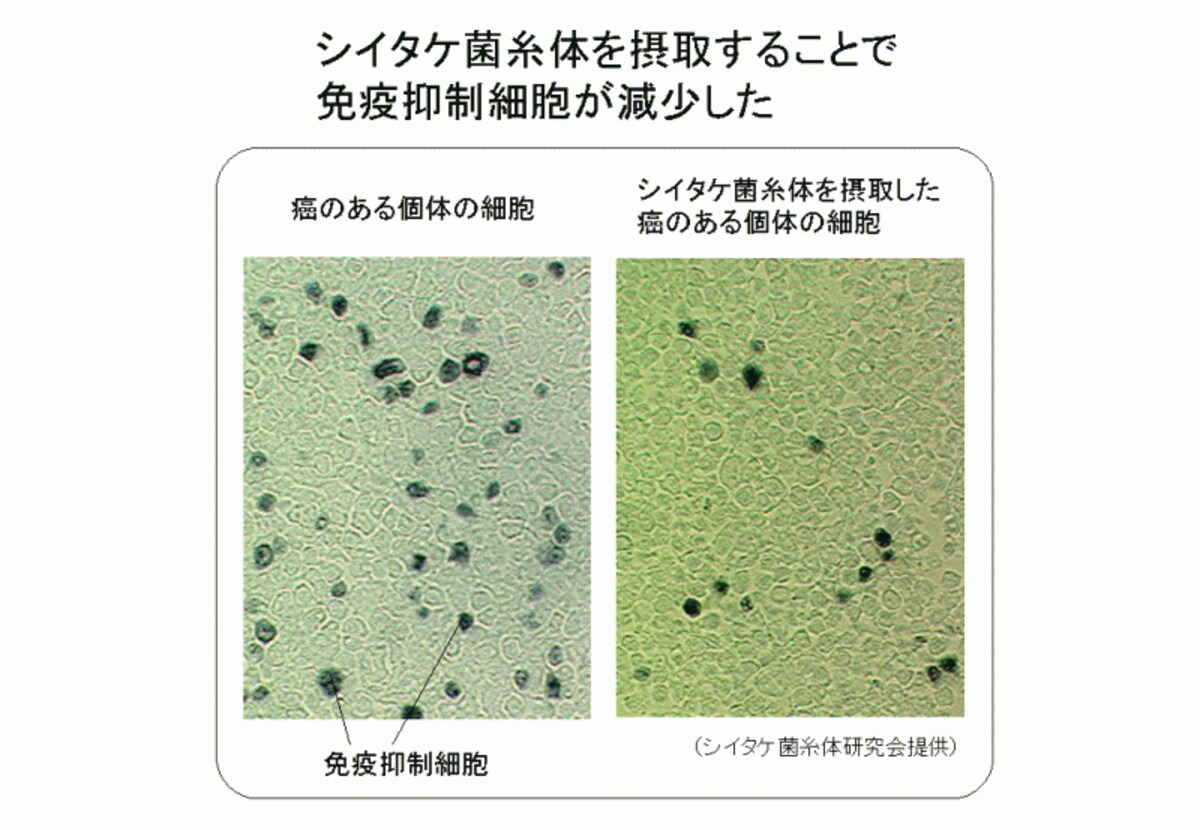 シイタケ菌糸体と免疫抑制細