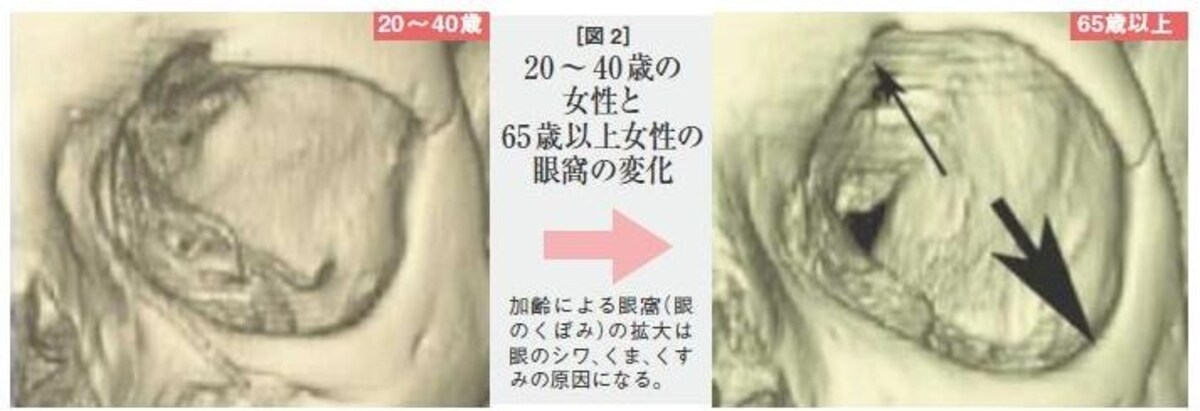 あ