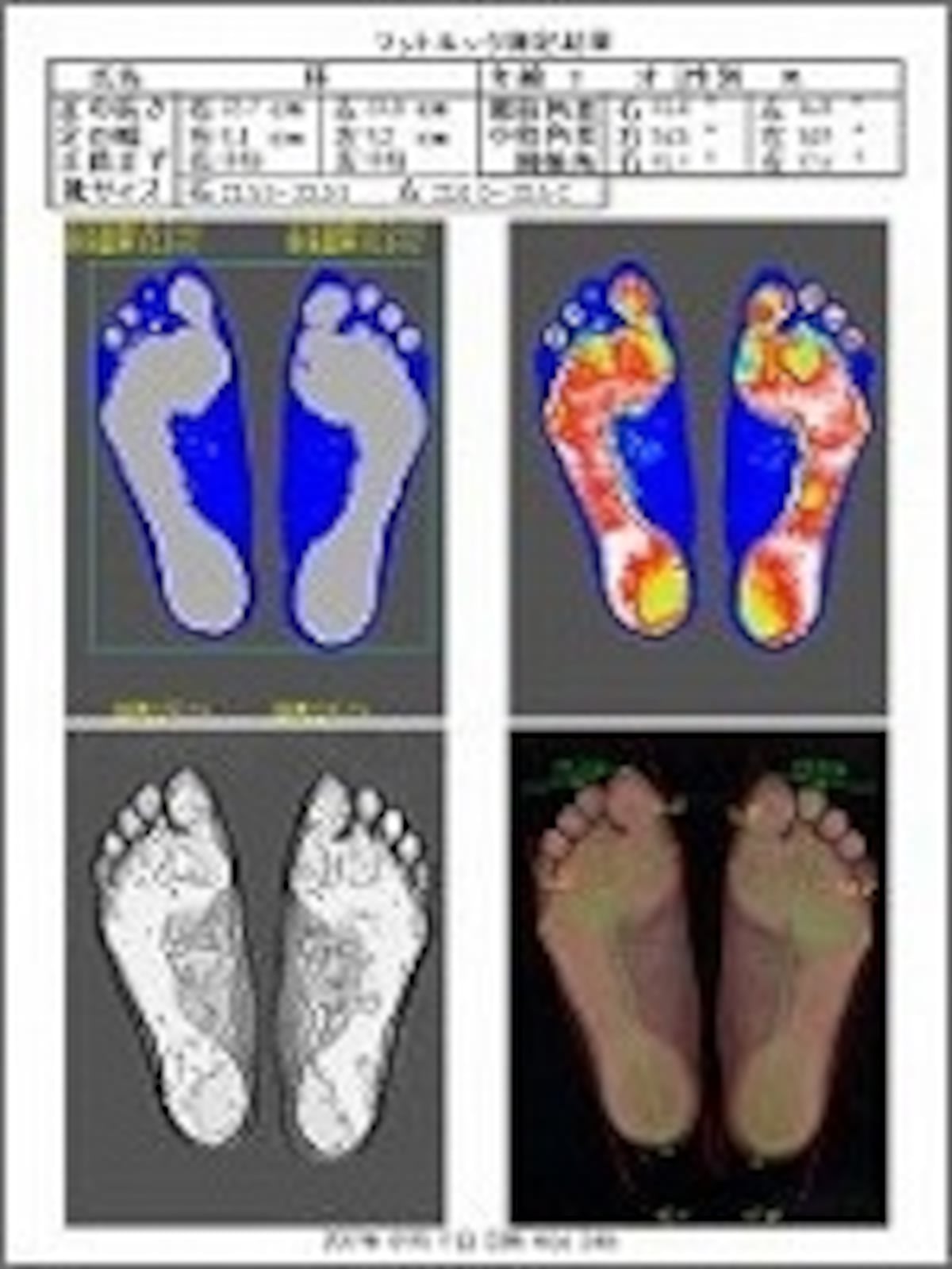 足裏の状態