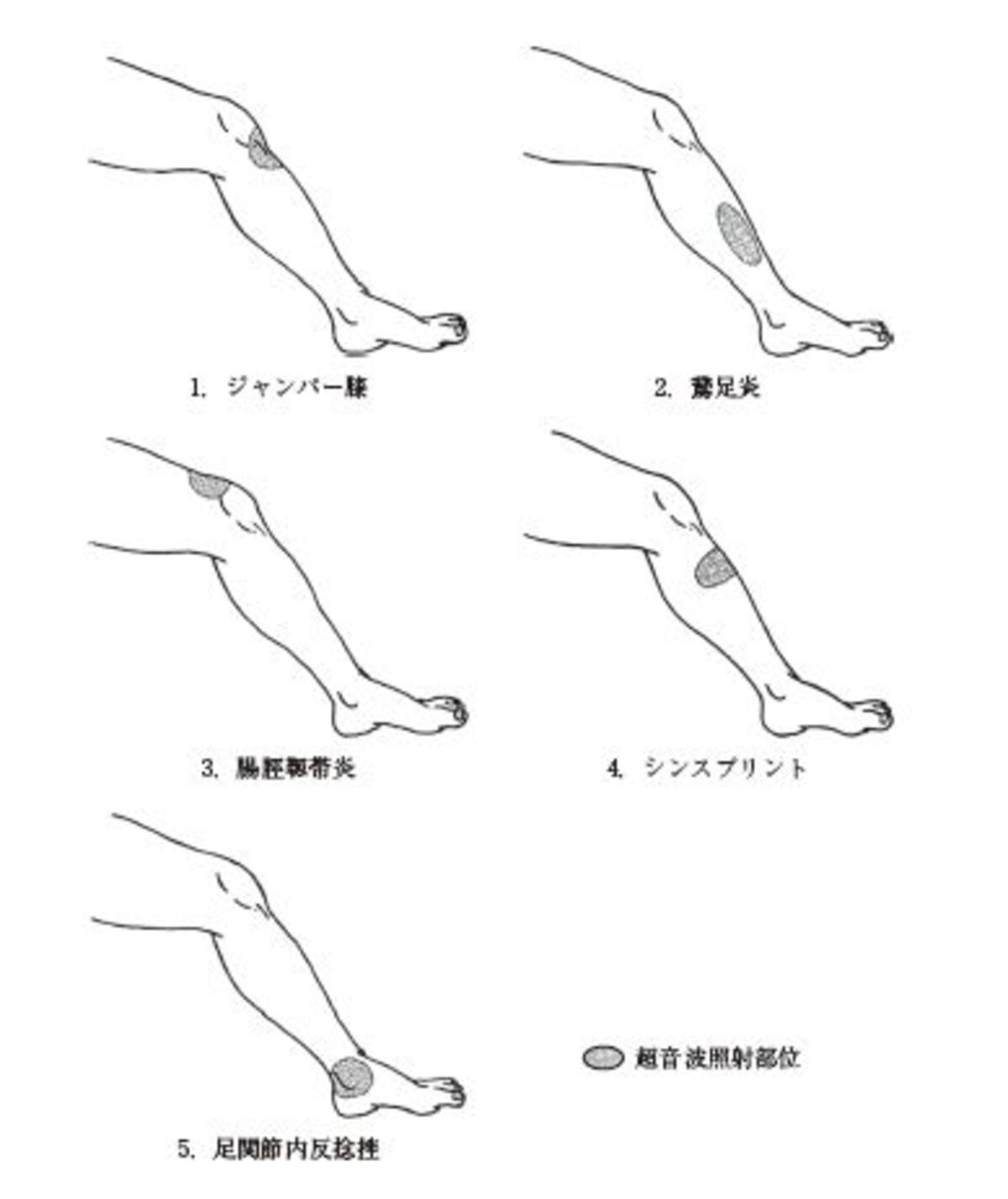 物理療法　問題