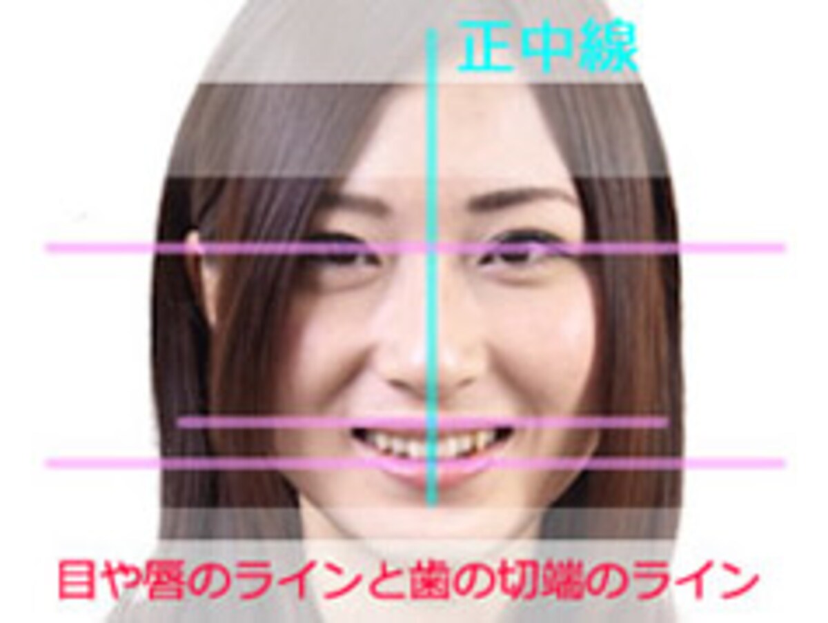 歯のラインと顔のラインを合わせるイメージで