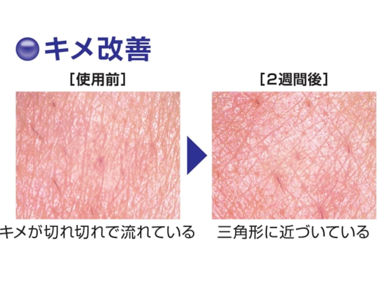 キメの改善