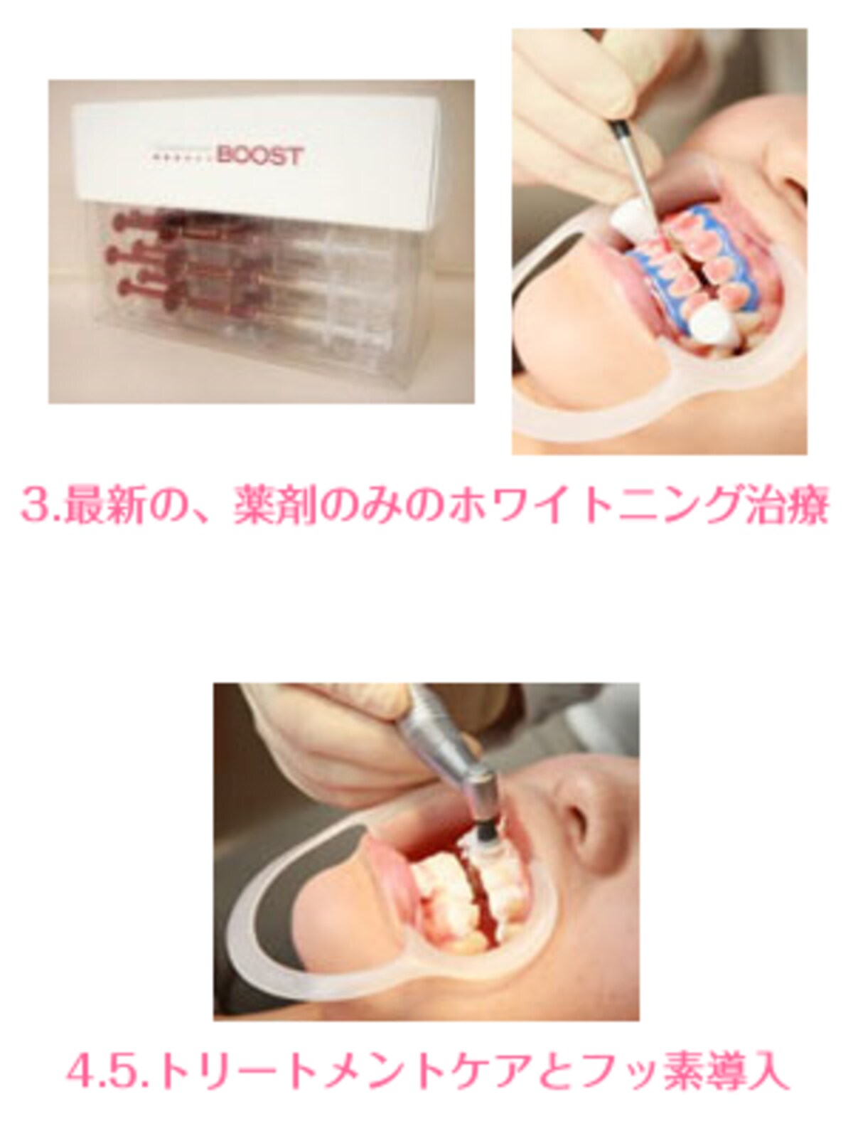オフィスホワイトニングの効果を最大限に引き出します