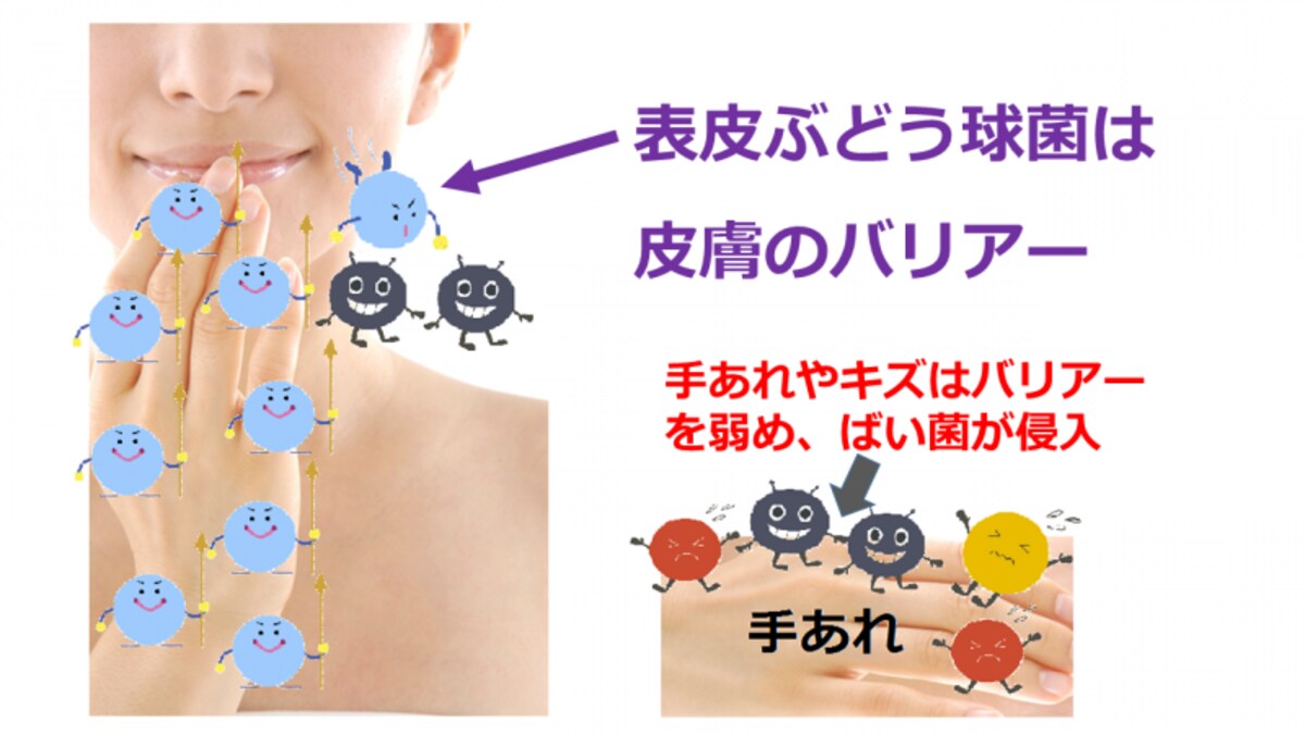 Important_Staphylococcus