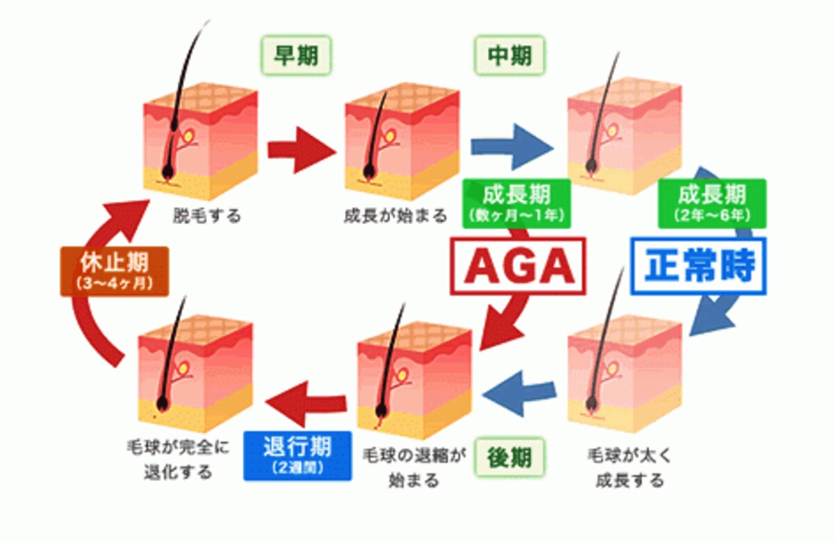 毛髪のサイクルとAGA