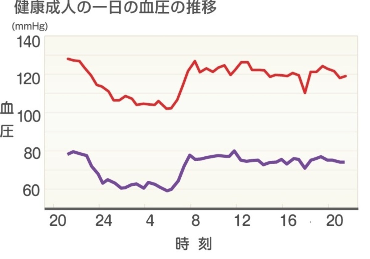 血圧推移グラフ