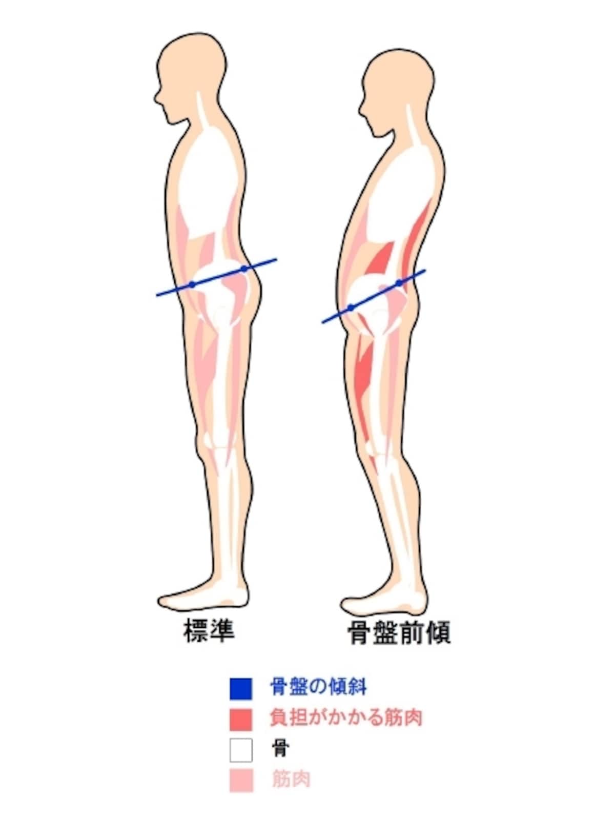 骨盤の傾斜