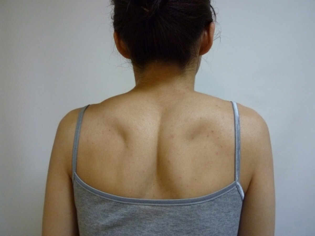 首を左右に動かし動きをチェック　肩をすくめ力を抜き、肩、肩甲骨のコリをチェック