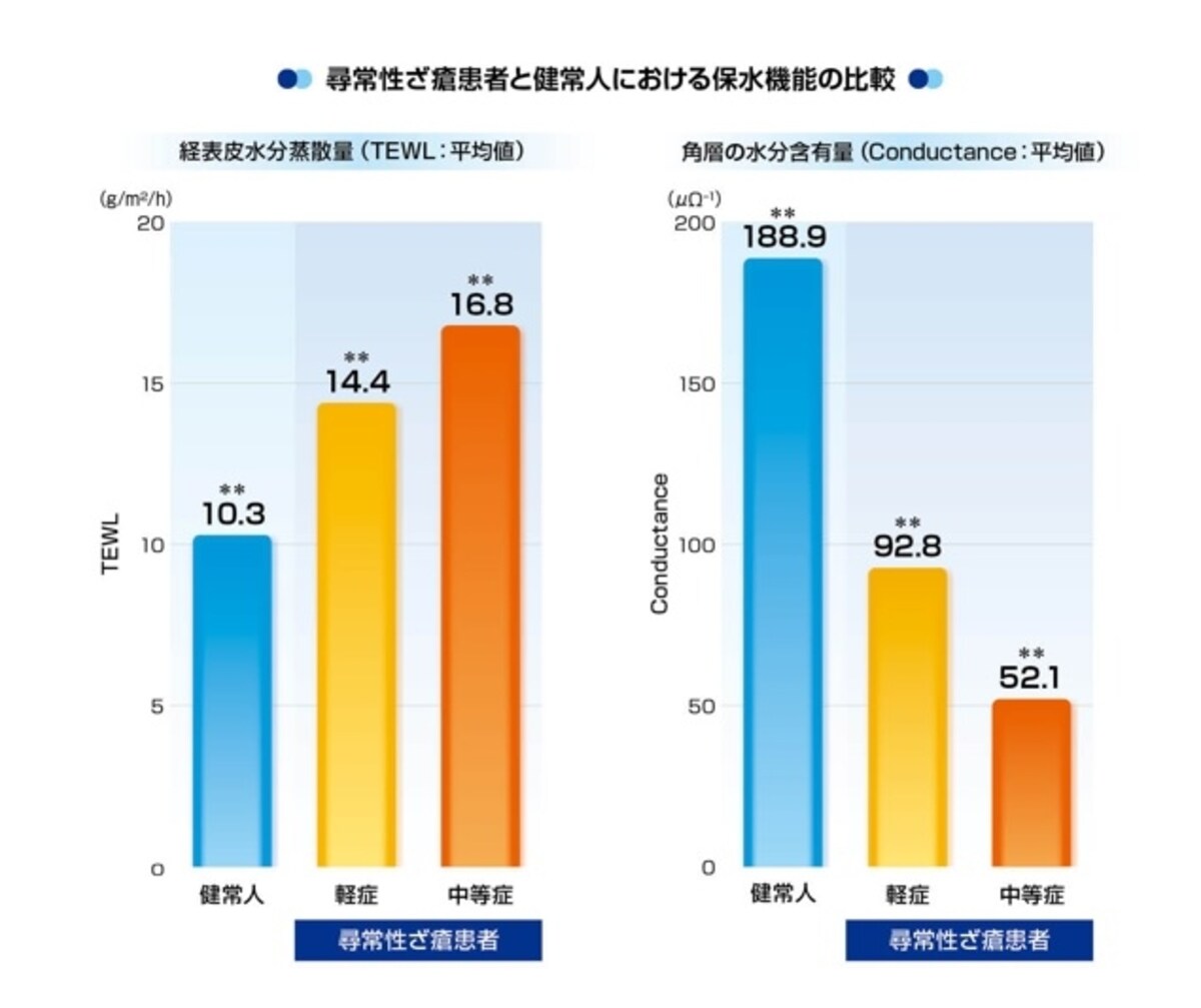 ニキビ肌と保湿機能低下