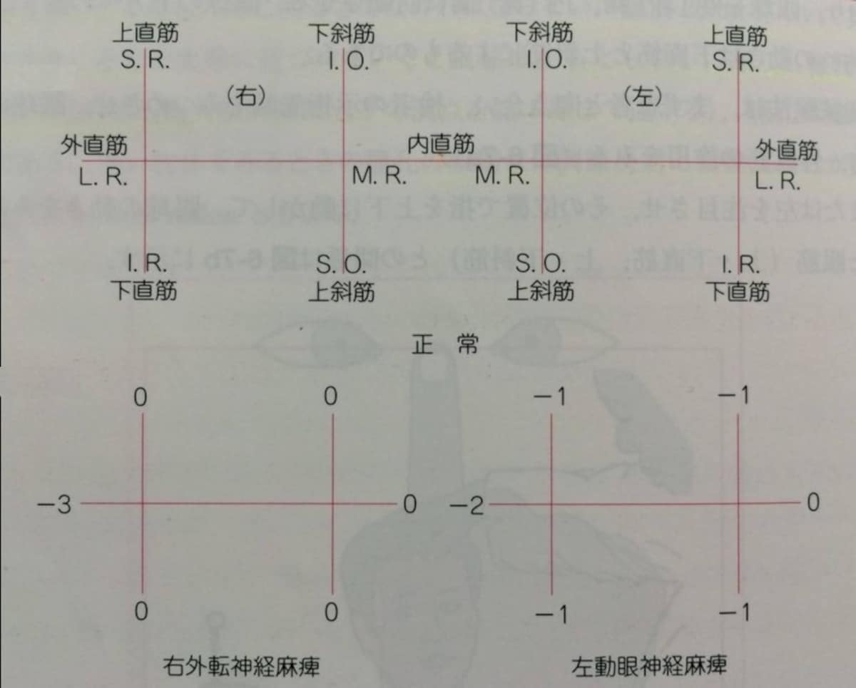 脳神経検査のひとつ、眼球運動。検査方法・評価尺度を解説。