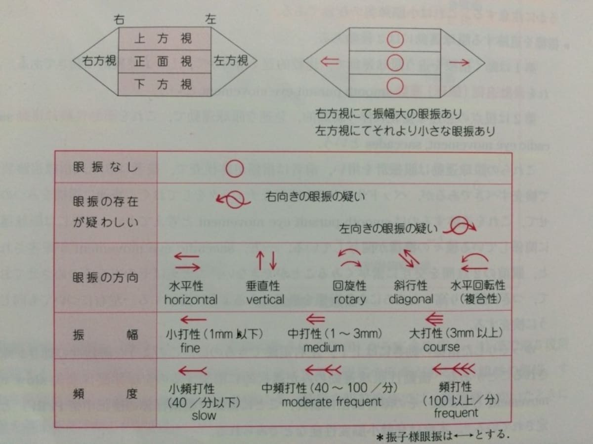 脳神経検査のひとつ、眼振。眼球運動の検査時に同時に確認する。検査方法・評価尺度・注意点を解説。