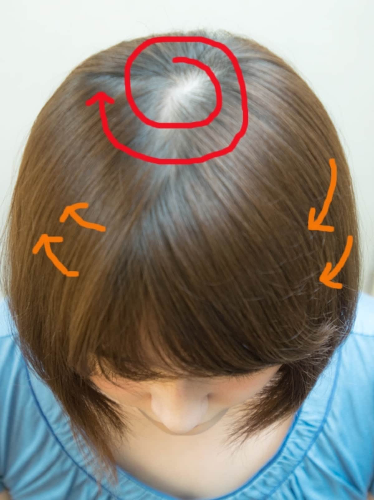 つむじから時計回りに生えているケースがほとんど