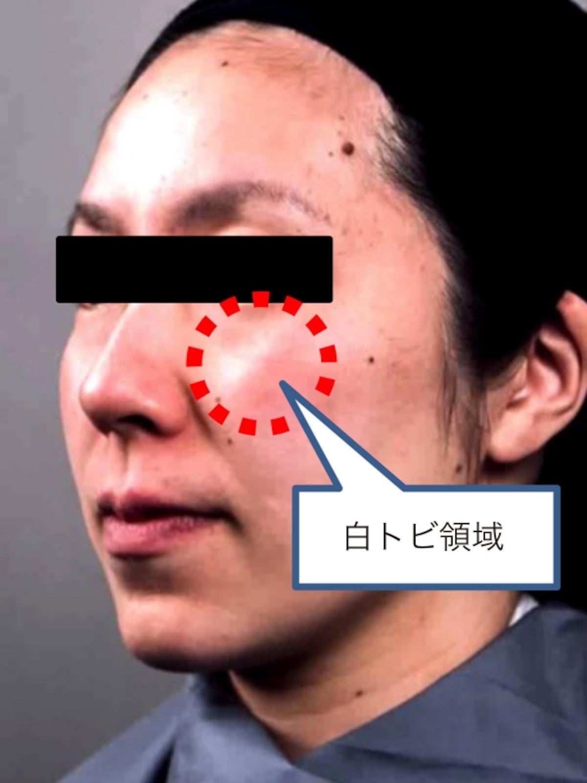 POLA　資料2