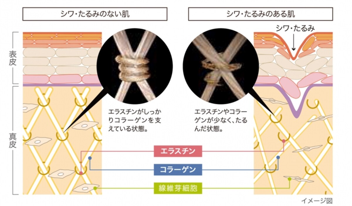 エラスチンが不足すると肌は弾力を失ってしまいます